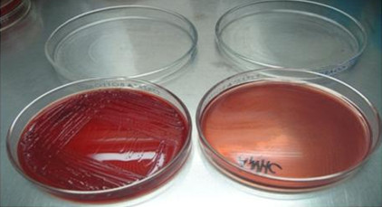 Tissue samples collected from sick animals are plated in petri dishes for bacterial isolation and identification.